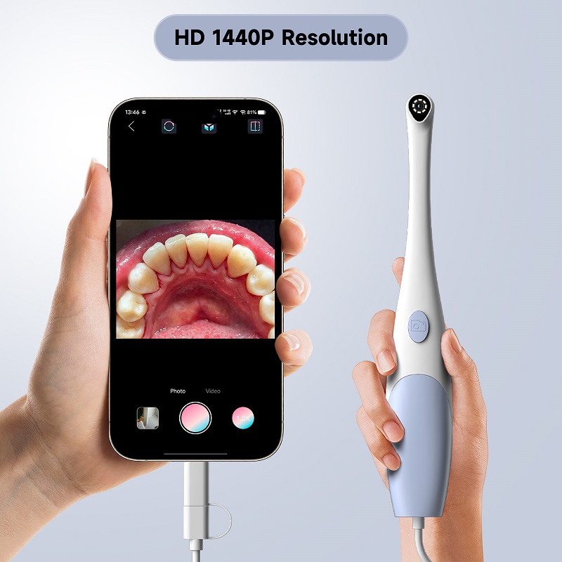 Oral Endoscope Camera 1440P Ph - đánh giá và giá Photography Lighting Professional