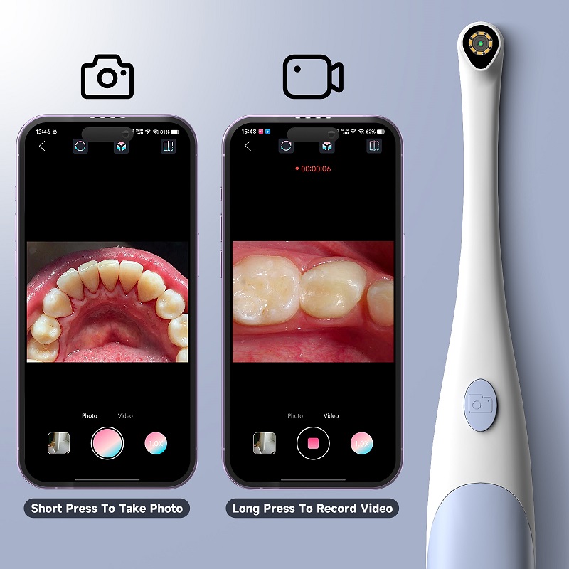 Oral Endoscope Camera 1440P Ph - đánh giá và giá Photography Lighting Professional